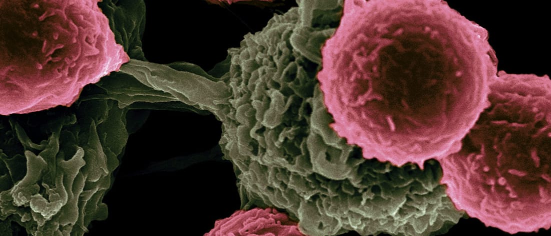 Impfstoff-basierte Immuntherapie gegen Krebs