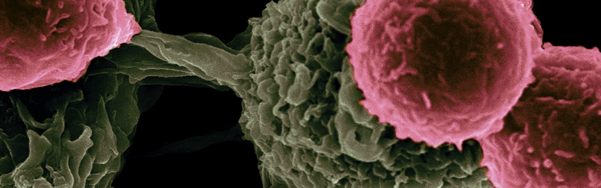 Impfstoff-basierte Immuntherapie gegen Krebs